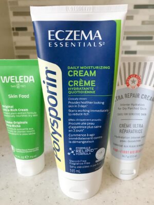 Best ways to combat Eczema ⋆ chic everywhere